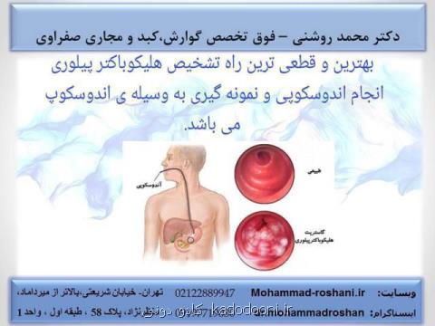 آندوسكوپی معده